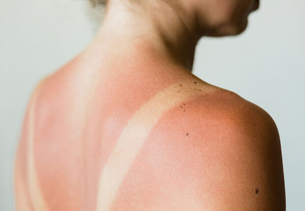 8 Reasons Why You Should Wear Sunscreen All Year Long